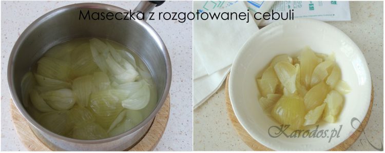 Maseczka z rozgotowanej cebuli na uporczywy trądzik i grzybicę Maseczka z rozgotowanej cebuli na uporczywy trądzik i grzybicę