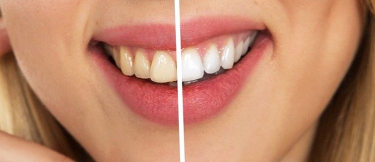 Domowe sposoby na białe zęby